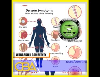 Xisbiga UCID ayaa xukumada Somaliland ku eedeeyay inay shacabka u qarisay khatarta xanuunka xummadda