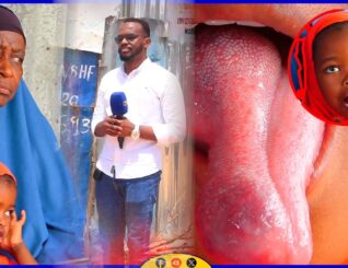 Gabar sadex sano jir ah oo meel halis ah kaga dhacay cudur noociisa ay garan waayeen dhakhaatiirta dalka.