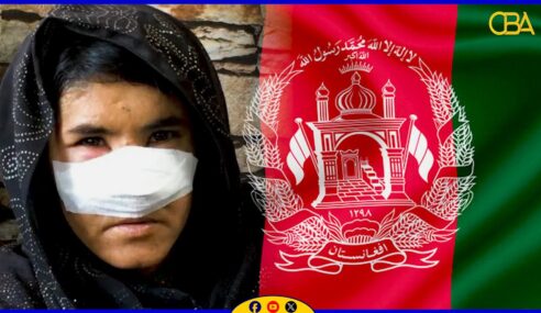 Nin naagtiisa sanka ka jaray maseer dartiis dalka Afghanistan